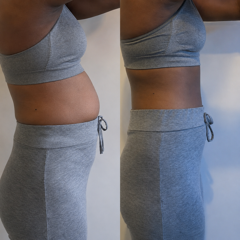Before and after
