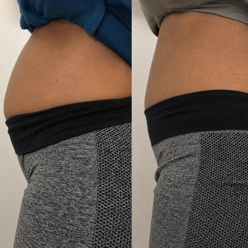 Before and after