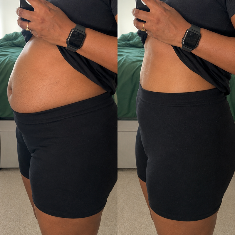 Before and after